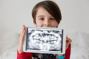 Dental X-Rays and Your Health at Muir Station Smiles in Concord, CA